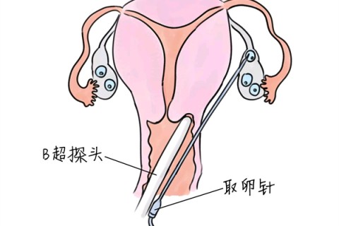 http://changsha.vdtfzz.com/post/205.html|长沙供卵助孕