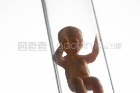 http://changsha.vdtfzz.com/post/197.html|长沙试管助孕